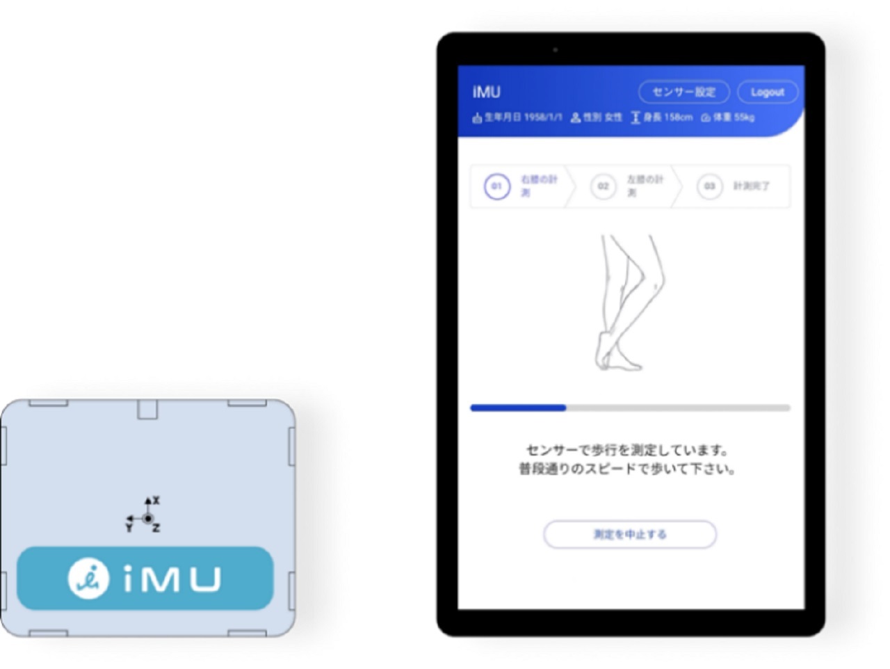 京セラ×iMU、歩行分析計の販売基本契約を締結--変形性膝関節症の